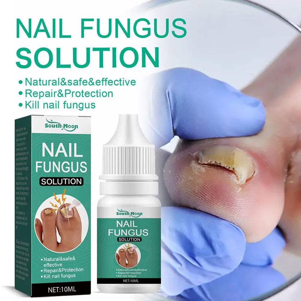 Fungal Nail Repair Serum 10ml Foot Toe Nail Fungus Atreatment Nails Gel Anti Paronychia Onychomycosis Care Essence