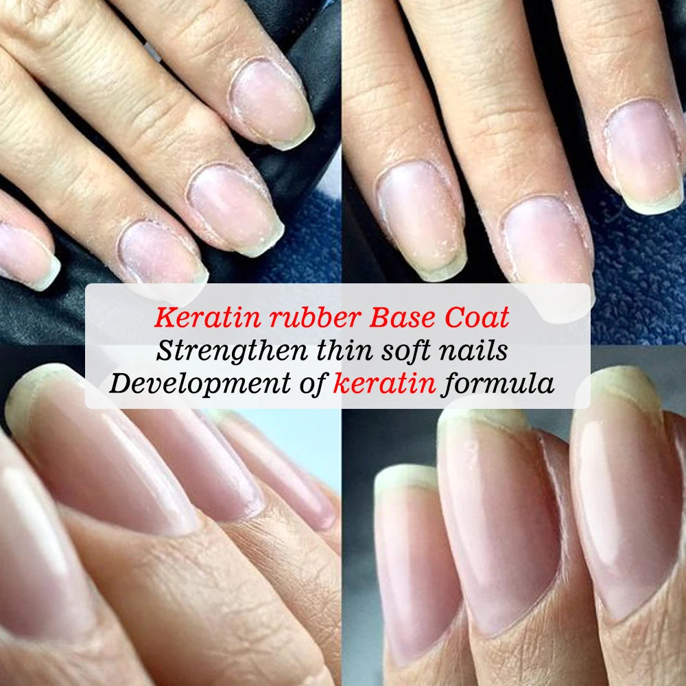 KODIES GEL Keratin Rubber Base Coat 15ML Nail Strengthener Gel Nail Polish Semi permanent UV Durable Base Varnish Protects Nails