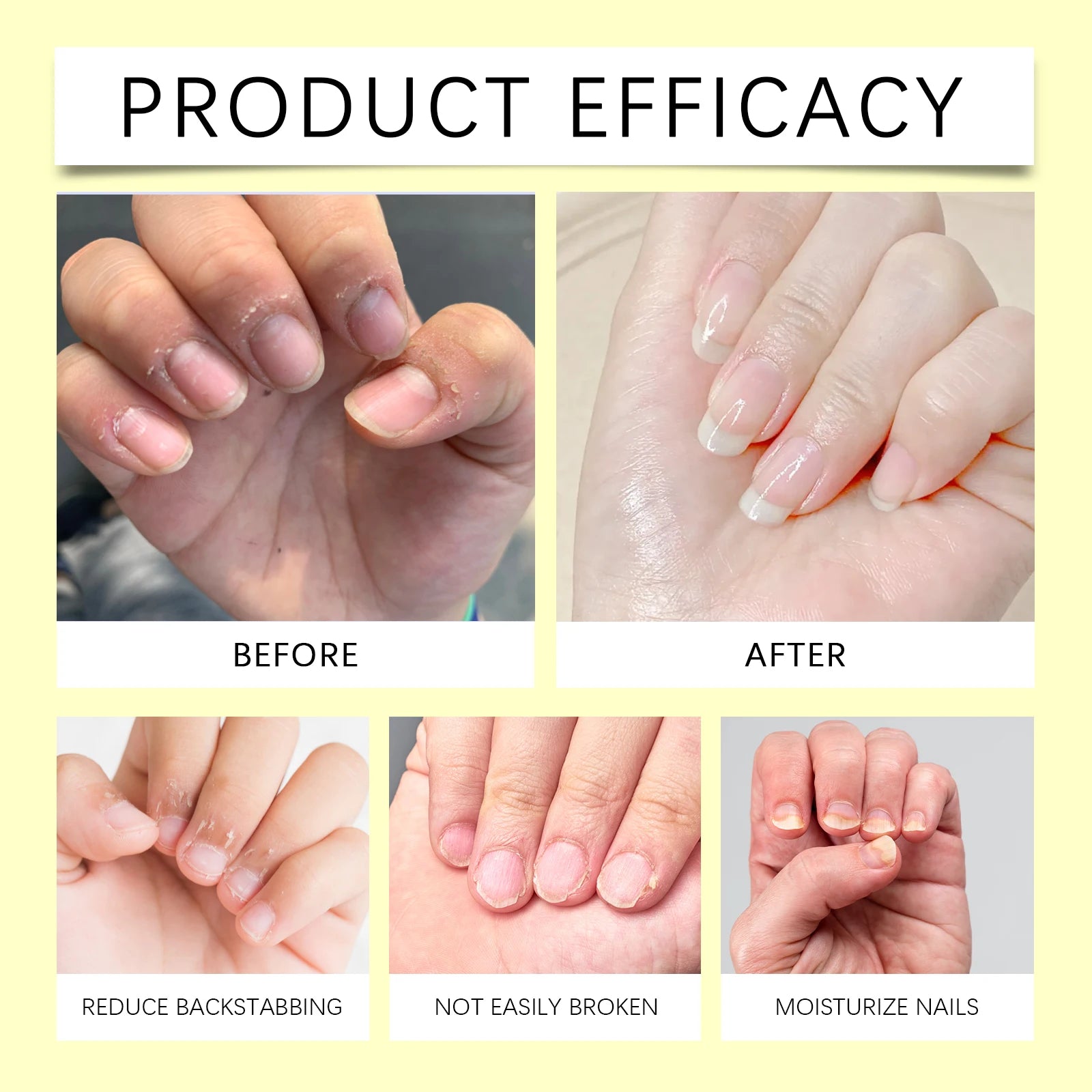 Nail Repair Serum Pen Cuticle Care Treatment for Brittle Nails Growth Strengthener Daily Nail Moisturizer Portable Kit with File