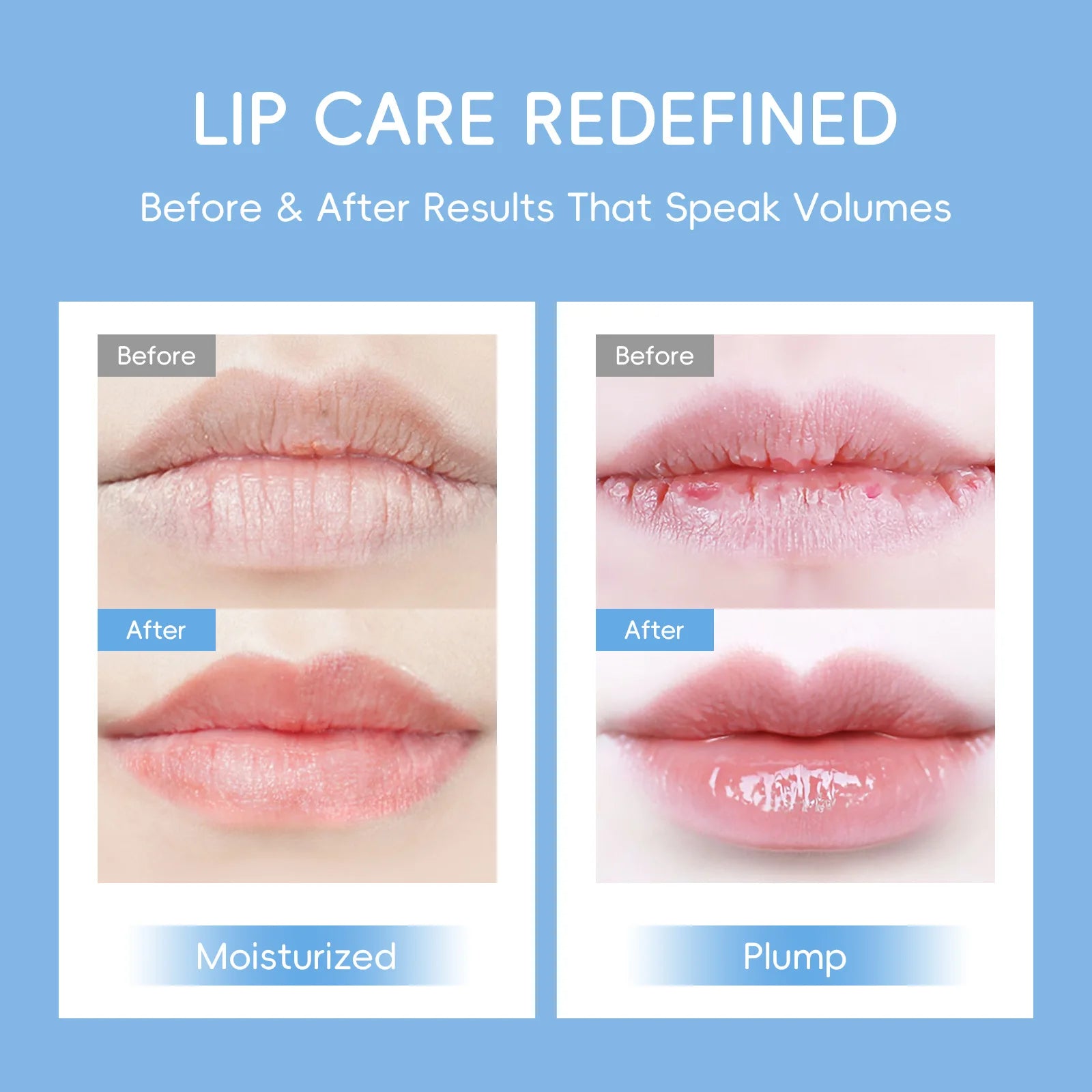 Laikou Milk Lip Mask Hydrating Repair Remove Lines Blemishes Lighten Lip Line Collagen Gel Lips Pad Patches Skin Care Product