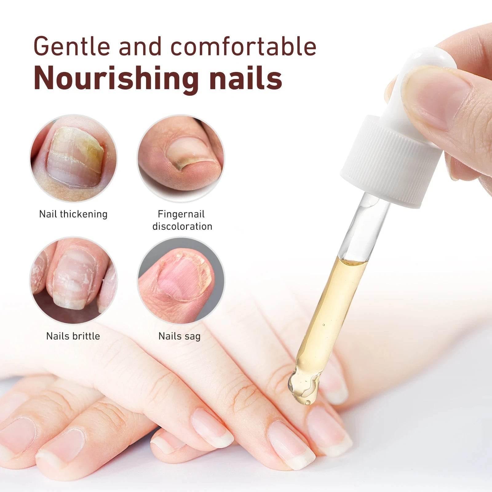 Fungal Nail Treatment Serum Foot Nail Fungus Removal Repair Gel Anti Infection Paronychia Onychomycosis Foot Nails Care Liquid