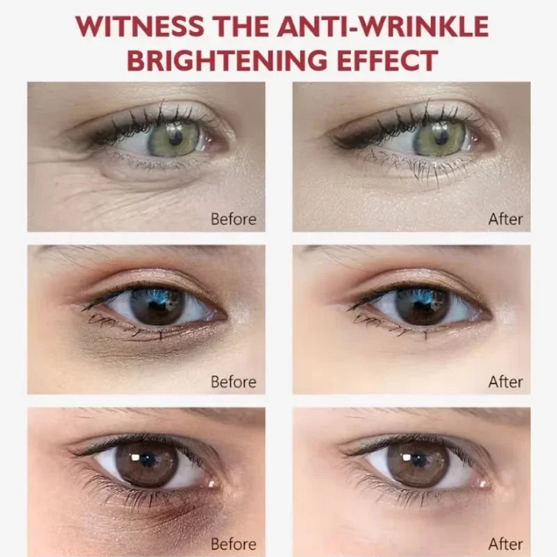Retinol Eye Cream Collagen Multibalm Stick Reduce Wrinkles Eye Bag Hyaluronic Acid Anti Dark Circle Puffiness Eye Care Products