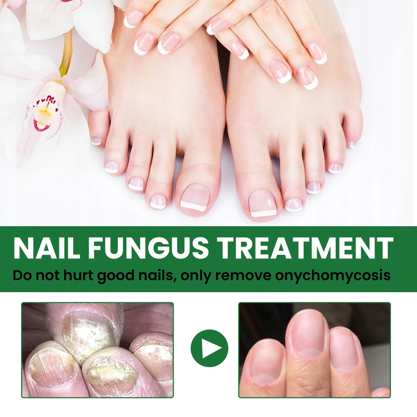Nail Treatment Solution Repair Damaged Nail Restore Healthy Growth Nourish Cuticles Strengthen Brittle Nail Recovery Care Lotion