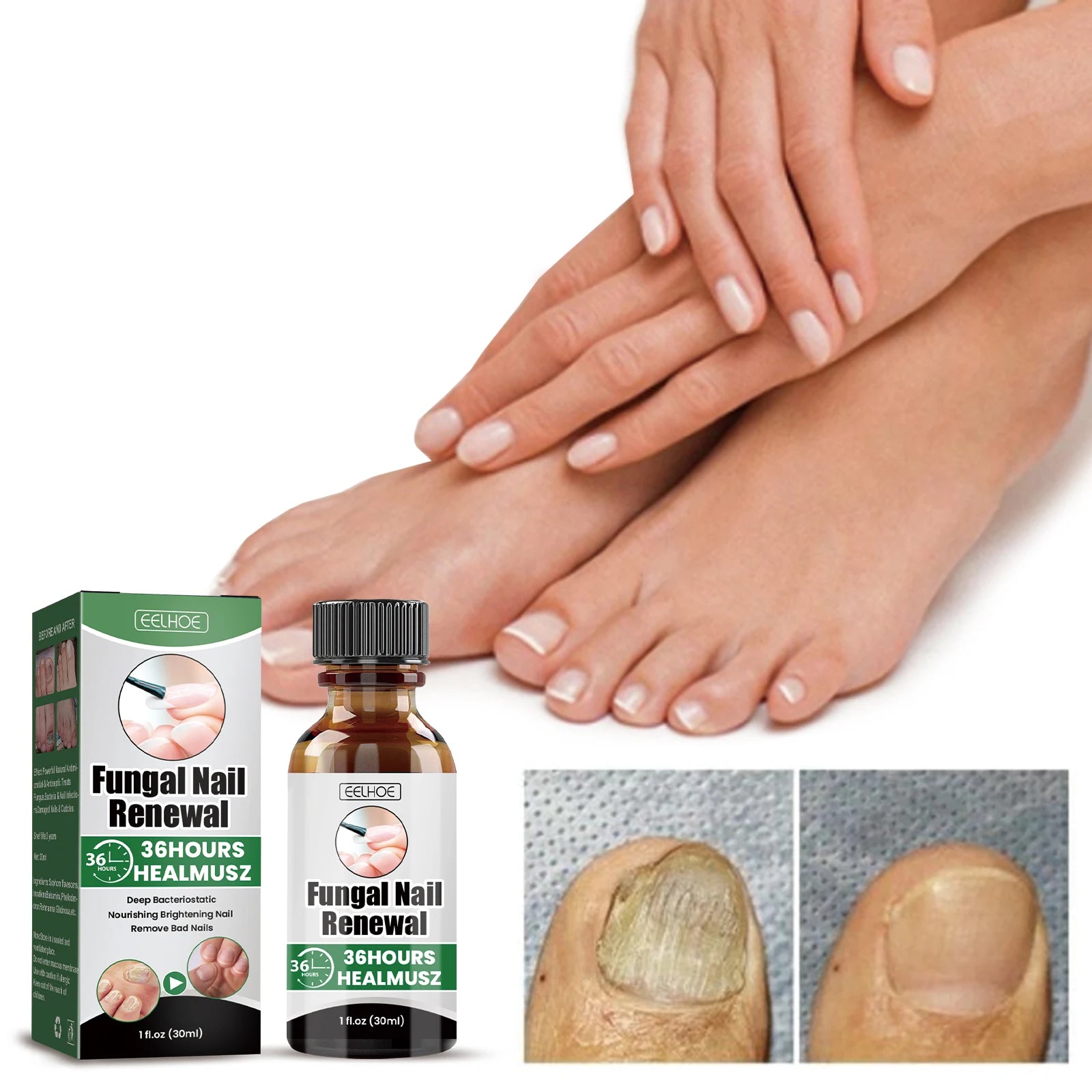 Nail Treatment Solution Repair Damaged Nail Restore Healthy Growth Nourish Cuticles Strengthen Brittle Nail Recovery Care Lotion