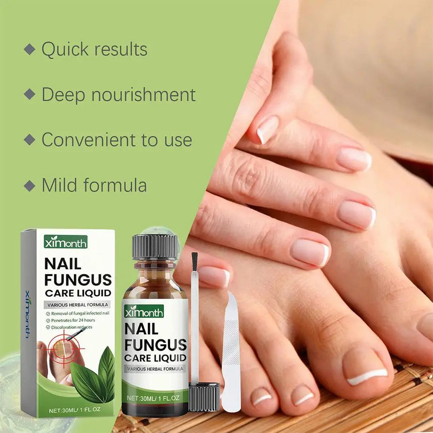 1/2/3pcs Hand Foot Onychomycosis Care Serum Toe Fungus Repair Anti Paronychia Relieve Ingrown Toenail Nail Fungal Treatment Oil