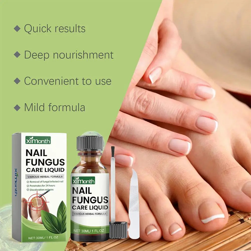 1/2/3pcs Hand Foot Onychomycosis Care Serum Toe Fungus Repair Anti Paronychia Relieve Ingrown Toenail Nail Fungal Treatment Oil