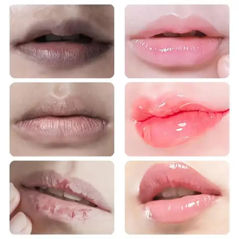 Remove Dark Lip Balm Fast Lightening Pink Lip Exfoliating Fade Lip Line Dead Skin Moisturizer Korean Care Products Beauty Health