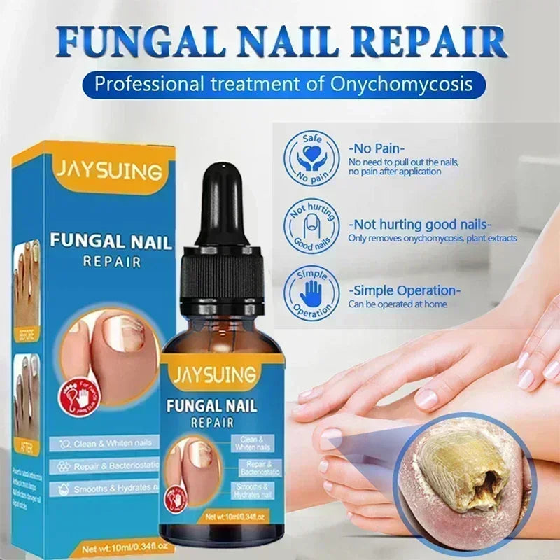 NewFungal Nail Treatment Oil Foot Repair Essence Toe Nail Fungus Removal Gel Anti Infection Cream Fungal Nail Removal Paronychi