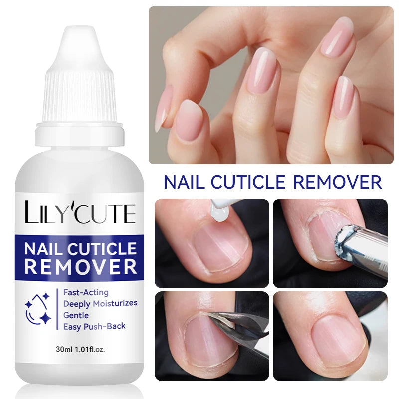 LILYCUTE 30ml Nail Cuticle Remover Quick Softening Gel for Dead Skin  Gentle Nail Care Easy Cuticle Cleaner for Manicure