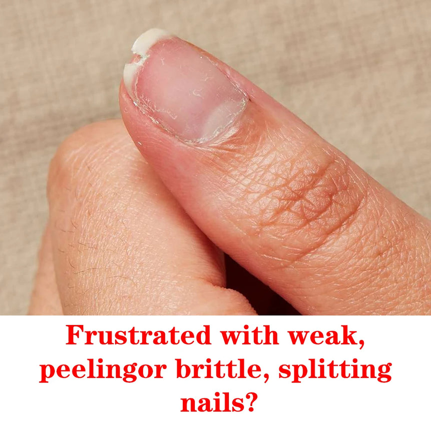 KODIES GEL Instant Nail Hardener Nail Growth Repair Treatment Polish Grow Strong Hard Thicker Nails Manicure Top Coat Bright Oil