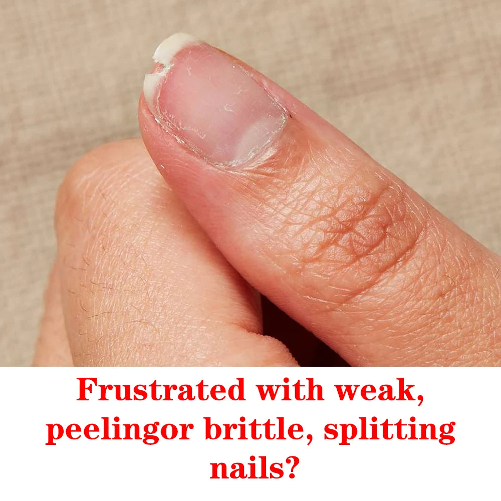 KODIES GEL Instant Nail Hardener Nail Growth Repair Treatment Polish Grow Strong Hard Thicker Nails Manicure Top Coat Bright Oil