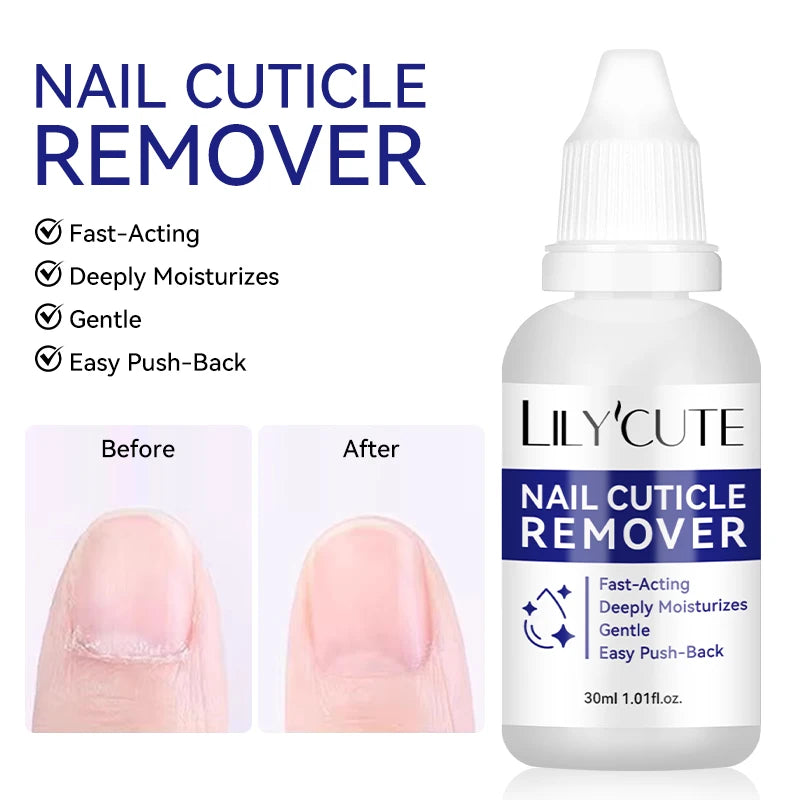 LILYCUTE 30ml Nail Cuticle Remover Quick Softening Gel for Dead Skin  Gentle Nail Care Easy Cuticle Cleaner for Manicure