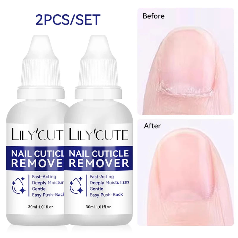 LILYCUTE 30ml Nail Cuticle Remover Quick Softening Gel for Dead Skin  Gentle Nail Care Easy Cuticle Cleaner for Manicure