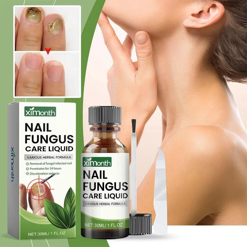 1/2/3pcs Hand Foot Onychomycosis Care Serum Toe Fungus Repair Anti Paronychia Relieve Ingrown Toenail Nail Fungal Treatment Oil