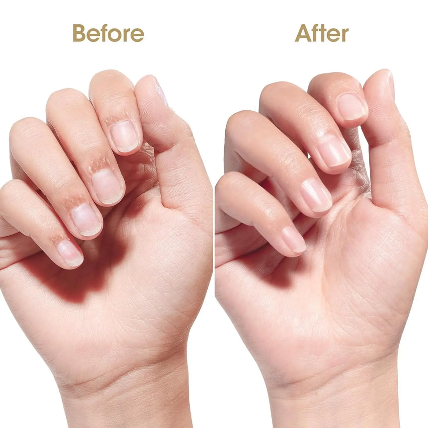 GELLEN 20ml Nails Cuticle Oil Organic Natural Keratin Vitamin E Nail Polish for Hydrating Nourishing Strengthening Supplies