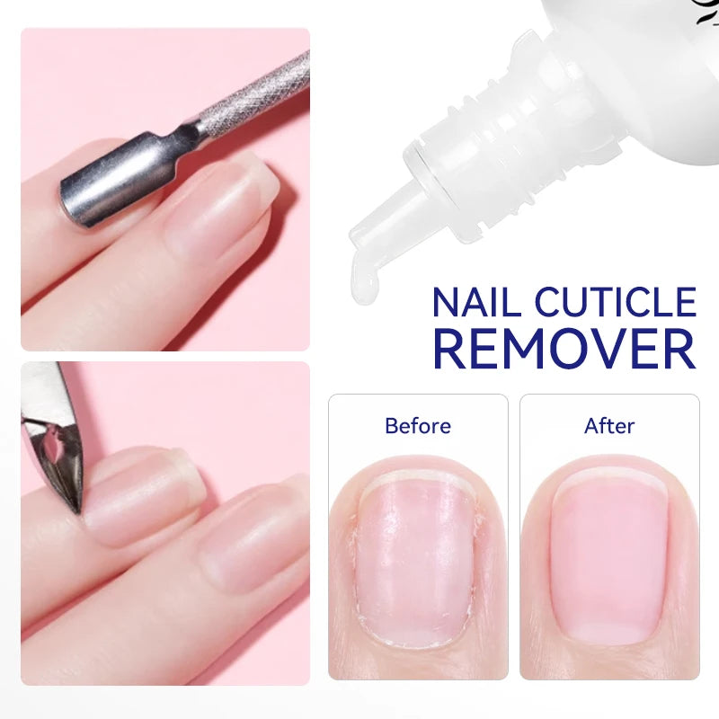 LILYCUTE 30ml Nail Cuticle Remover Quick Softening Gel for Dead Skin  Gentle Nail Care Easy Cuticle Cleaner for Manicure