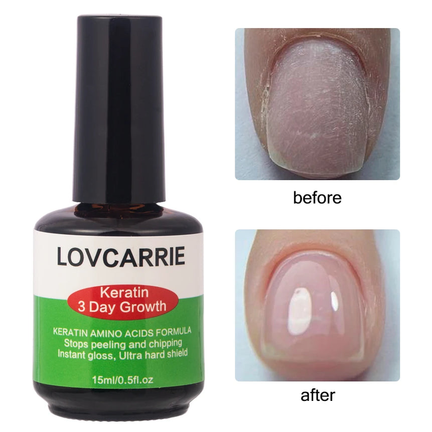 LOVCARRIE Keratin Nail Treatment Growth Formula Protein Normal Nail Strengthener Top Repair Serum Liquid 15ML Healthy Care Toe