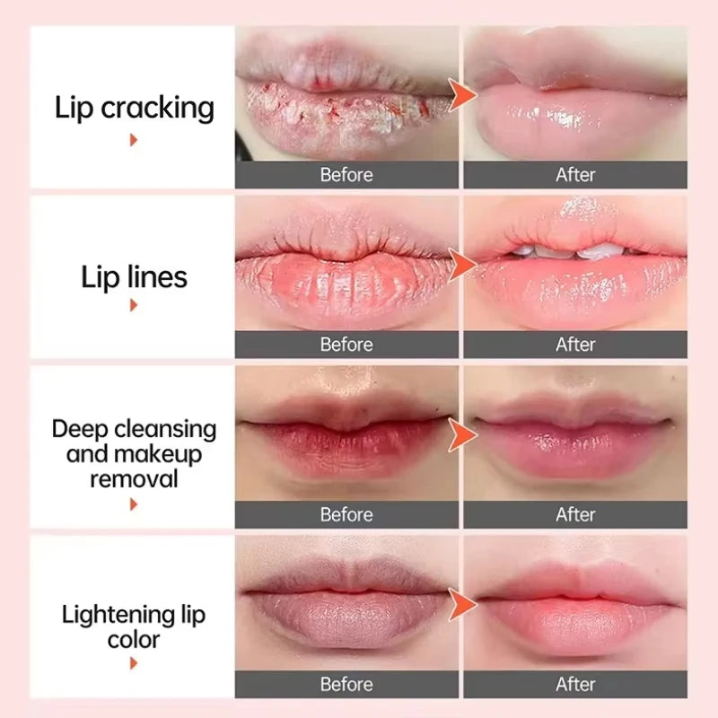 Remove Dark Smoke Lip Balm Lightening Melanin Bleaching Gloss Oil Lips Pink Lipstick Exfoliating Fade Lip Lines Nourish Lip Care
