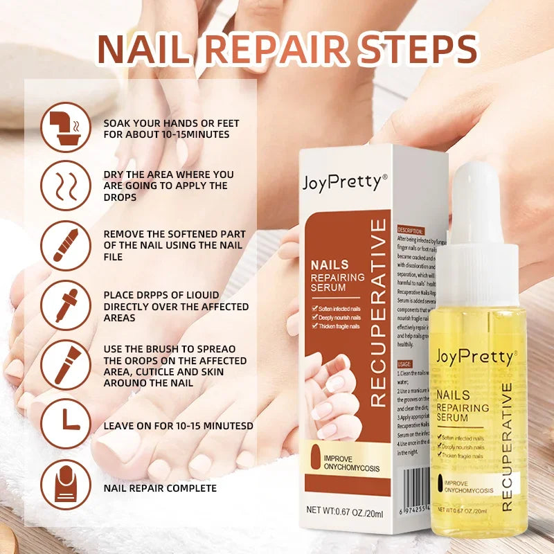 Fungal Nail Treatment Serum Foot Nail Fungus Removal Repair Gel Anti Infection Paronychia Onychomycosis Foot Nails Care Liquid