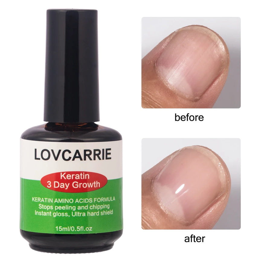 LOVCARRIE Keratin Nail Treatment Growth Formula Protein Normal Nail Strengthener Top Repair Serum Liquid 15ML Healthy Care Toe