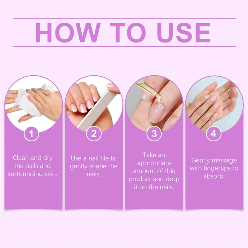 Fungal Nail Treatment Serum Foot Nail Fungus Removal Repair Gel Anti Infection Paronychia Onychomycosis Foot Nails Care Essence
