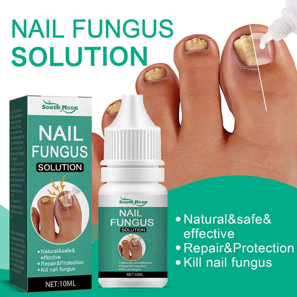 Fungal Nail Repair Serum 10ml Foot Toe Nail Fungus Atreatment Nails Gel Anti Paronychia Onychomycosis Care Essence