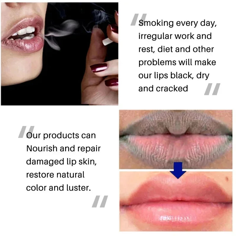 Remove Dark Smoke Lip Balm Lightening Melanin Bleaching Gloss Oil Lips Pink Lipstick Exfoliating Fade Lip Lines Nourish Lip Care
